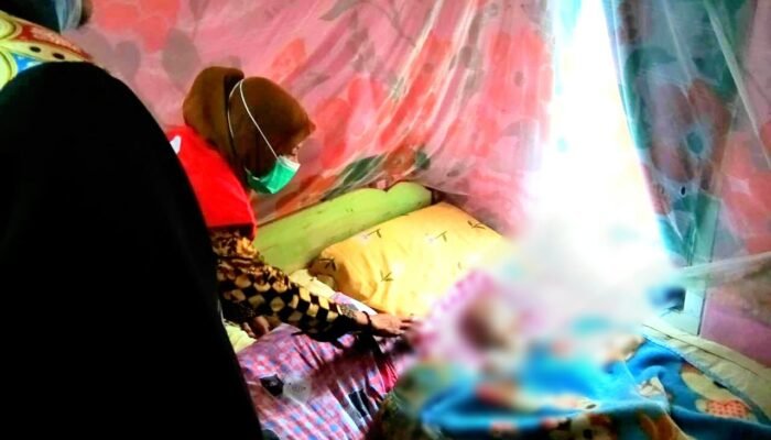 Bocah 9 Tahun Penderita Hydrochepalus Butuh Uluran Tangan